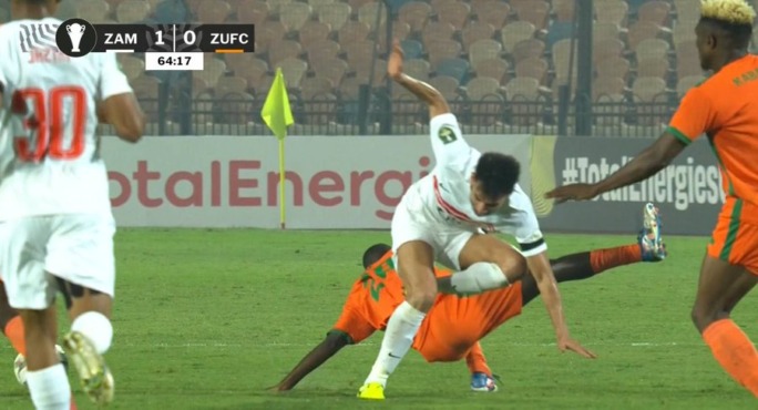 الزمالك يكشف طبيعة اصابة دونجا أمام زيسكو، عاجل